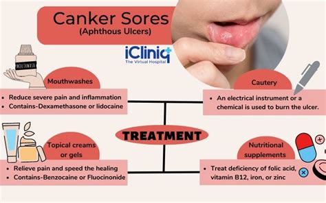 Canker Sores Symptoms Causes Diagnosis Treatment