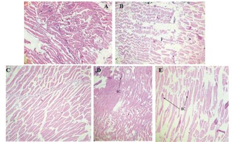 Sublethal Effects Of Atrazine On Muscle Histology Of S Esocinus A