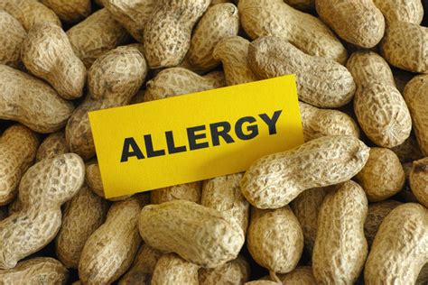 Peanut Allergy Six Genes Found That Drive Allergic Reaction
