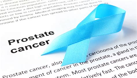 Prostate Cancer Overview Causes Early Symptoms Treatment