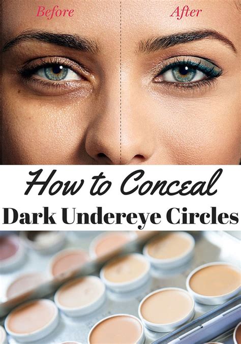 How To Conceal Dark Under Eye Circles Dark Circles Under Eyes Dark Under Eye Undereye Circles
