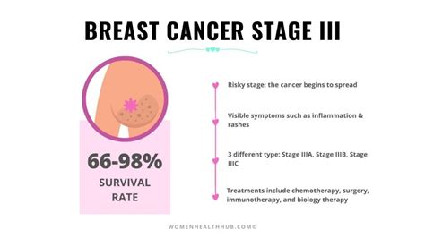 Breast cancer won't stop so we won't either. Everything About 5 Stages of Breast Cancer With Treatments