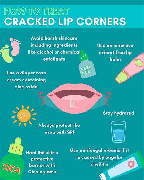 How To Effectively Heal Cracked Lip Corners Fast Landys Chemist