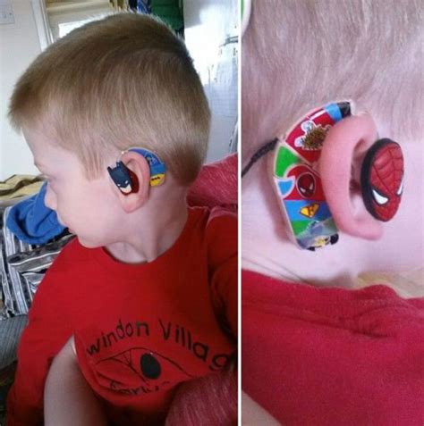 Uk Mom Makes Cool Hearing Aids That Kids Love To Wear