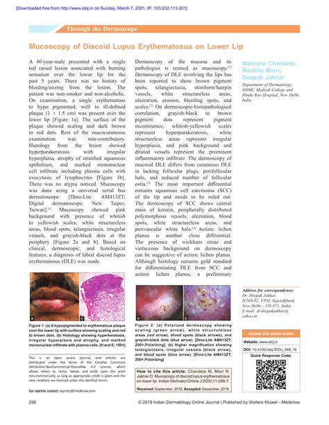 Pdf Mucoscopy Of Discoid Lupus Erythematosus On Lower Lip