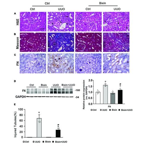 Bixin Prevents The Renal Interstitial Fibrosis Caused By Uuo Kidney