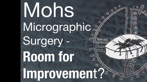 Mohs Micrographic Surgery Room For Improvement Youtube