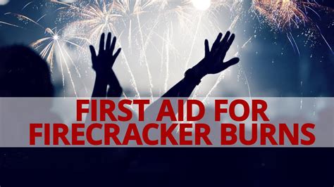How To Do First Aid For Firecracker Burns Bealifesaver Youtube