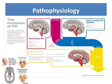 Ppt Parkinsons Disease Powerpoint Presentation Free Download Id