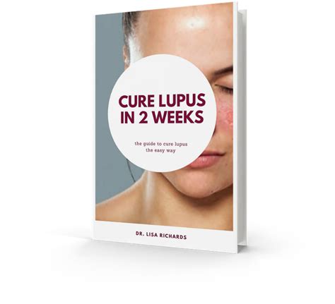 Lupus Cure