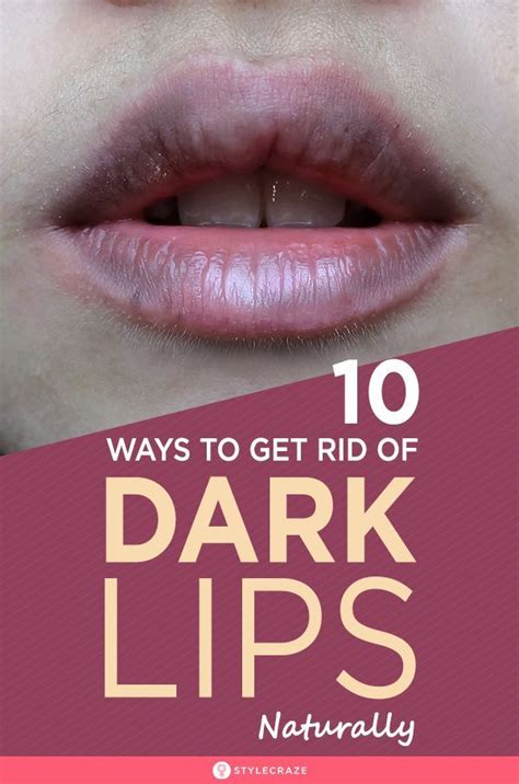10 Proven Ways To Get Rid Of Dark Lips Naturally Worked For 99 People