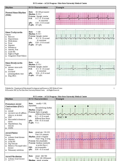 Ekg Examples Of Interpretation Cardiac Nursing Ekg Interpretation