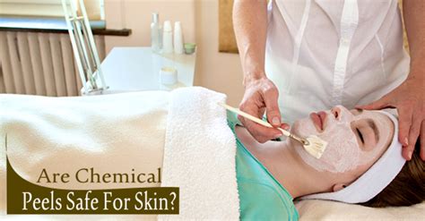 Are Chemical Peels Safe For Your Skin Centre For Dermatology