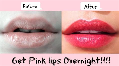 How To Get Pink Lips Overnight Lighten Dark Lips Naturally At Home