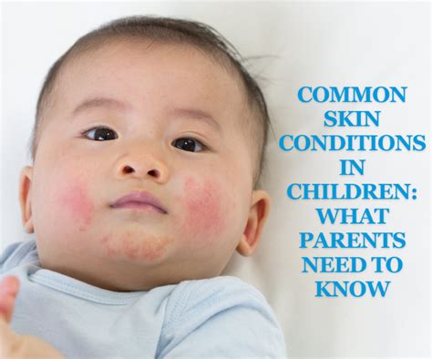 Common Skin Conditions In Children What Parents Need To Know Oakland