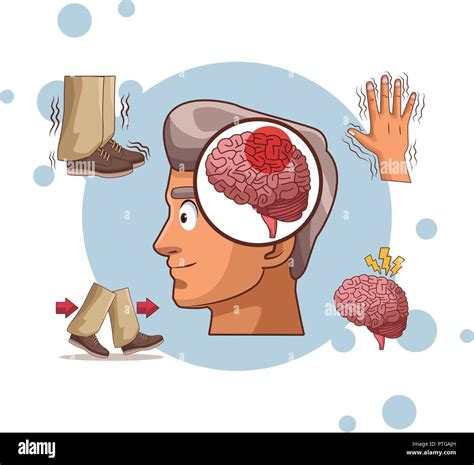 Alzheimer Disease Cartoon Stock Vector Image And Art Alamy