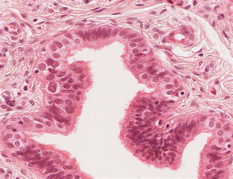 Epithelial Tissue Histology Slides Tissue Types Histology Slides