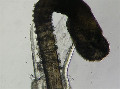 Under The Microscope Hair Follicle Nerve Endings