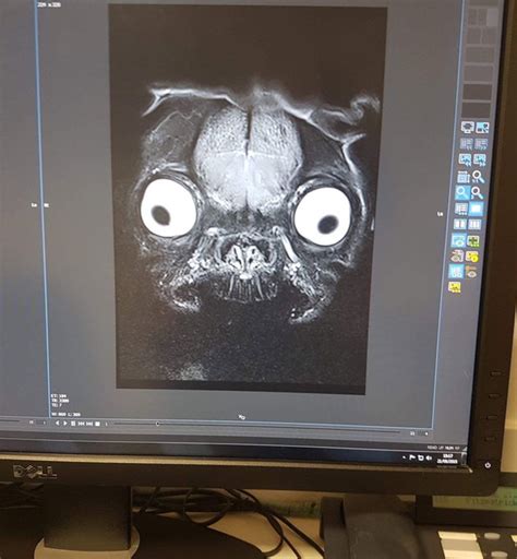 People Freak Out Over This Mildly Terrifying Mri Scan Of A Pug 9gag