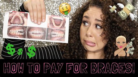 Adult Braces How To Pay For Braces Without Insurance How Much Im Paying For Braces Youtube