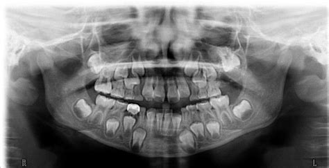 Com Sept 2012 Diagnosis Uw School Of Dentistry