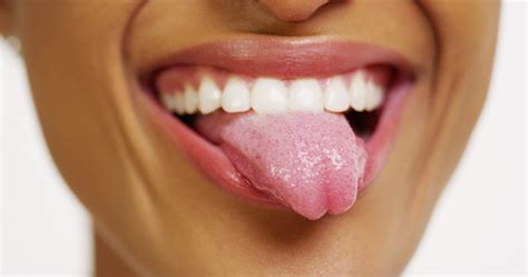 ¿tu Lengua Es Un Criadero De Bacterias Salud