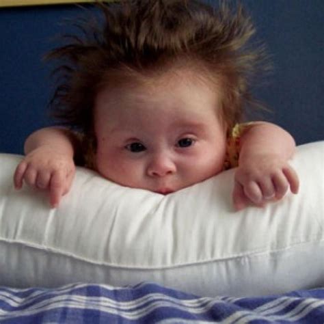 Albums 91 Wallpaper Pictures Of Down Syndrome Babies Excellent