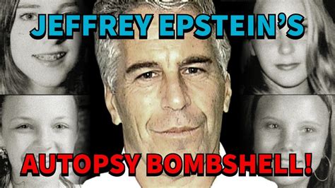 Jeffrey Epstein Autopsy Results And The Inconsistencies Full Breakdown