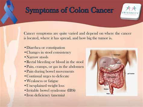 Colon Cancer Symptoms Colorectal Cancer Facts Symptoms Diagnosis