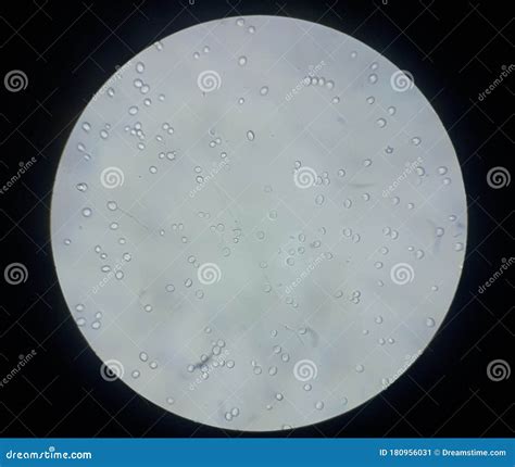 Yeast Sample Under The Microscope Stock Image Image Of Yeast Nucleus