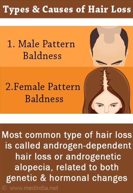 Share 83 Main Causes Of Hair Loss Super Hot Vn