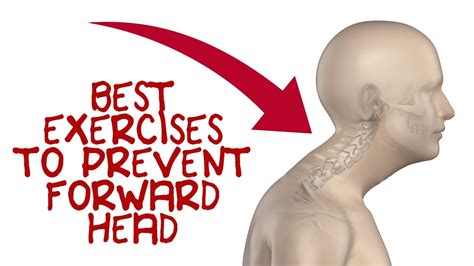 Forward Head Exercises To Fix Forward Head Posture Youtube