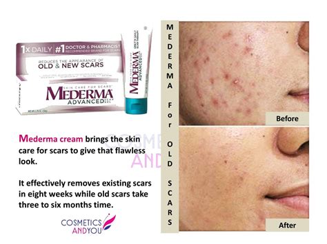 Mederma Reviews For Old Scars Cosmetics And You Acne Treatment