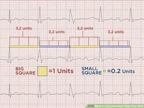 How To Calculate Heart Rate Ecg