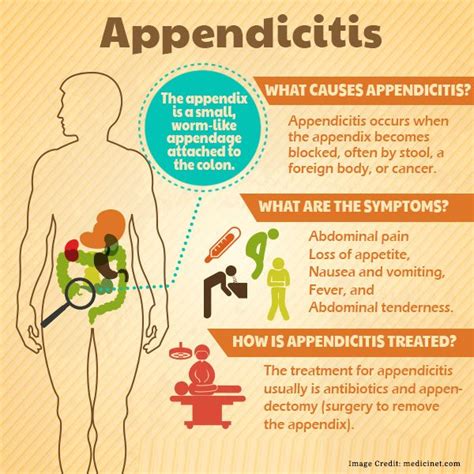 All About Appendicitis Early Signs And Symptoms Causes Treatment
