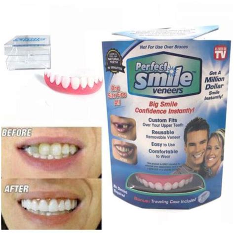 Does any insurance cover dental veneers? Perfect Smile Veneers Teeth Cover price from noon in Saudi Arabia - Yaoota!