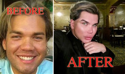 Rodrigo Alves Before And After Pics Human Ken Doll Who Has Had Fifty Procedures Express Co Uk
