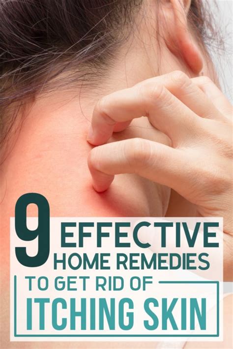 9 Effective Home Remedies To Get Rid Of Itching Skin