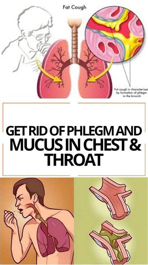 Get Rid Of Phlegm And Mucus In Chest And Throat Getting Rid Of Phlegm