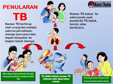 Penyakit Tuberculosis Homecare24