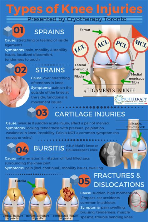 5 Types Of Knee Injuries Symptoms Which One Do I Have 2024
