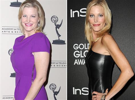 Breaking Bad Star Anna Gunn Shows Off New Look