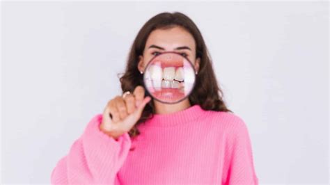 Malocclusion In Adults Causes Consequences And Treatment
