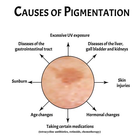 Skin Pigmentation Causes Symptoms And Solutions Clearskin