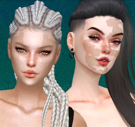 Download Vitiligo All Ages The Sims 4 Mods Curseforge