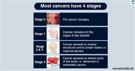What Does The Stages Of Cancer Mean Best Home Design Ideas