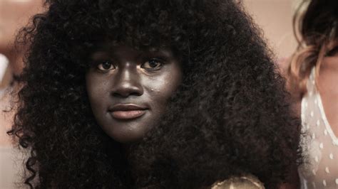 This Model Is Speaking Out About Being Bullied For Having Dark Skin Via