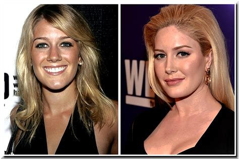 Surgery Heidi Montag Then And Now Heidi Montag S Before And After Beauty Evolution Elle