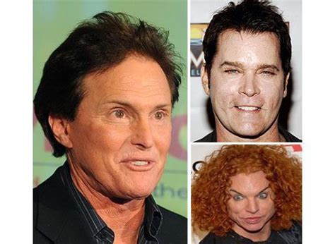 8 Of The Worst Male Celebrity Plastic Surgeries These Hollywood Hunks Went From