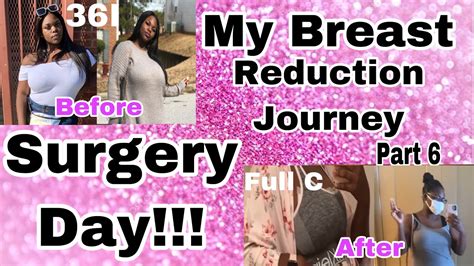 My Breast Reduction Journey Part Surgery Day Youtube
